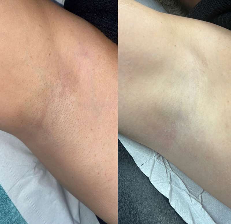 Nola Cyperus Rotundus Oil