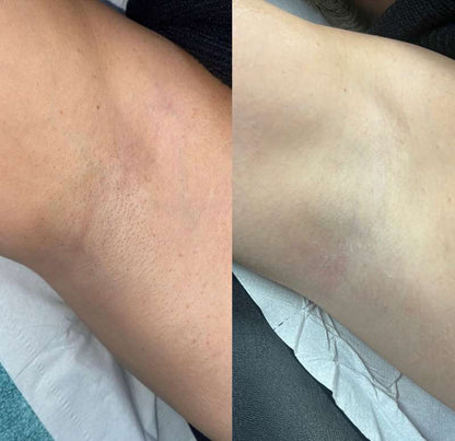 Nola Cyperus Rotundus Oil