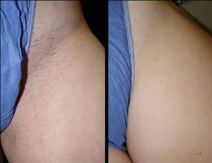 Nola Cyperus Rotundus Oil